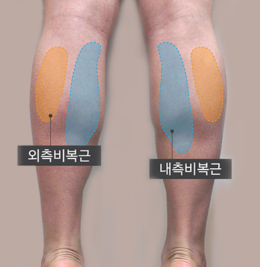 외측비복근, 내측비복근