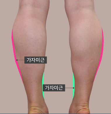 가자미근